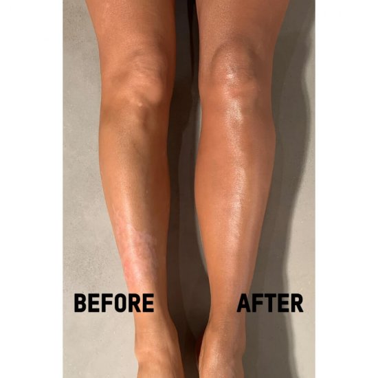 Lotiune Dupa Plaja Shimmer ELMIPLANT Sun, 200ml, Crema Dupa Plaja, Lotiune pentru Piele Bronzata, Crema Piele Bronzata, Lotiune dupa Bronz, Lotiune Hidratanta dupa Bronz, Lotiune Piele Bronzata, Lotiune de Plaja, Lotiune Plaja Elmiplant