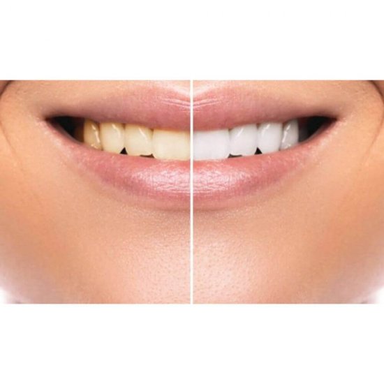 Pasta de Dinti COLGATE Max White Extra Care Sensitive Protect, 75 ml, Pasta de Dinti pentru Albire, Pasta de Dinti pentru Dinti Sensibili, Pasta Dinti Colgate, Pasta Dinti Albire, Pasta Dinti Sensibili, Articole Igiena Dentara