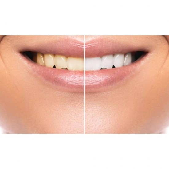 Pasta Dinti Colgate Cavity Protection, 100 ml, Pompita, Fresh Mint, Pasta de Dinti Anticarii, Articole Igiena Dentara, Pasta de Dinti Anticarii, Produse pentru Ingrjire Orala, Produse pentru Sanatate Orala, Igiena Orala, Ingrijire si Igiena Orala