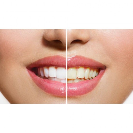 Periuta Dinti Colgate 360 Expert White Med, Periute Albire Dinti COLGATE, Periute de Dinti  AlbiColgate pentru Adulti, Periute de Dinti Manuale, Perii de Dinti, Articole de Igiena Orala, Ingrijire Orala, Sanatate Orala, Ingrijire si Protectie Dentara