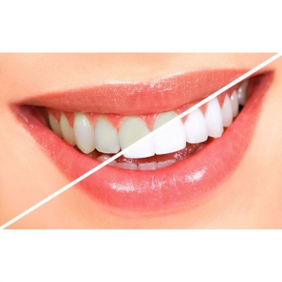 Periuta de dinti Colgate Slim Soft Black cu Peri Moi si Varf Subtire,  Periute de Dinti Sensibili Colgate pentru Adulti, Periute de Dinti Manuale, Perii de Dinti, Articole de Igiena Orala, Ingrijire Orala, Sanatate Orala, Ingrijire si Protectie Dentara