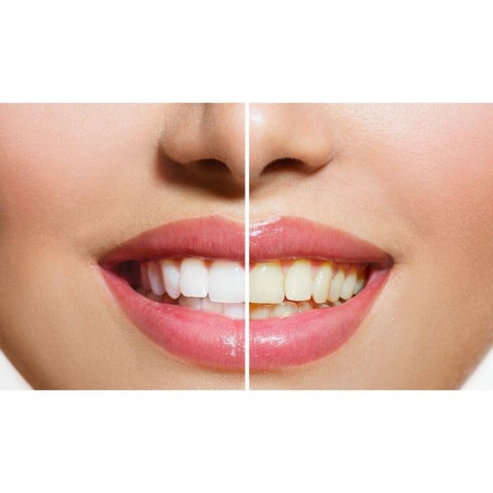 Pasta de Dinti COLGATE Total Original, 100 ml, Pasta de Dinti Colgate Total, Colgate Total Original Pasta de Dinti 100 ml, Pasta de Dinti Colgate Original, Pasta de Dinti Colgate, Pasta de Dinti, Pasta de Dinti Anticarii, Pasta de Dinti Albire