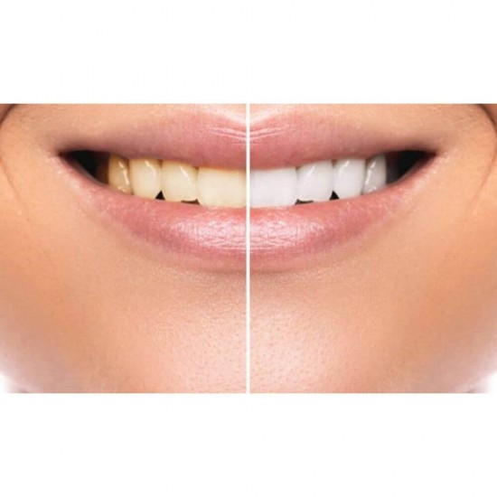 Pasta de Dinti COLGATE Advanced White Pump, 100 ml, Pasta de Dinti Anticarii, Pasta de Dinti Albire, Pasta de Dinti Colgate, Colgate White Pump, Colgate White Pump Pasta de Dinti 100 ml