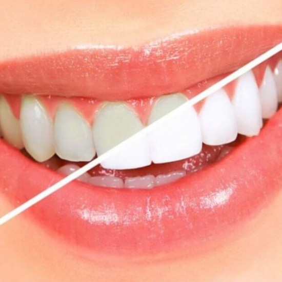 Periuta de Dinti Colgate Zig Zag Charcoal, Duritate Medie, Perie de Dinti, Periuta de Dinti, Periuta Colgate, Periuta pentru Dinti, Periuta Colgate pentru Dinti, Periuta Colgate de Dinti, Perie Curatare Dinti, Periute de Dinti, Perii de Dinti